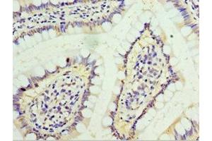 Immunohistochemistry of paraffin-embedded human small intestine tissue using ABIN7156601 at dilution of 1:100