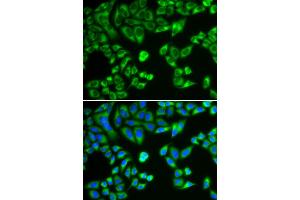 Immunofluorescence analysis of HeLa cells using SH2B1 antibody. (SH2B1 Antikörper)