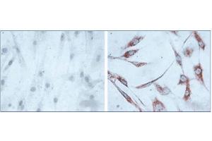 Immunohistochemistry of human skin fibroblasts (Left: control, Right: 24 hours after 7th passage of senescence). (HSPD1 Antikörper)