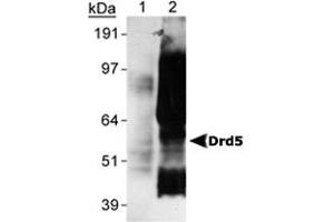 Detection of Drd5 of Sf9 cells transfected with rat Drd5 using Drd5 monoclonal antibody, clone SG4-D1b . (DRD5 Antikörper  (C-Term))