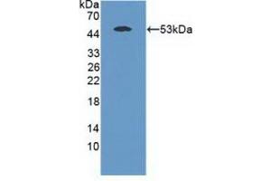 Detection of Recombinant MASP1, Mouse using Polyclonal Antibody to Mannose Associated Serine Protease 1 (MASP1) (MASP1 Antikörper  (AA 25-453))