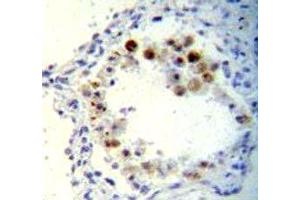 Immunohistochemistry (IHC) image for anti-Cyclin-Dependent Kinase Inhibitor 2B (p15, Inhibits CDK4) (CDKN2B) (AA 102-130) antibody (ABIN3030647)