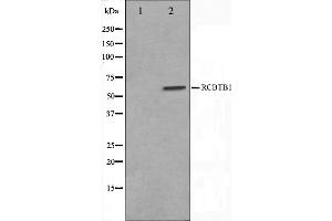 Western blot analysis on LOVO cell lysate using RCBTB1 Antibody,The lane on the left is treated with the antigen-specific peptide.