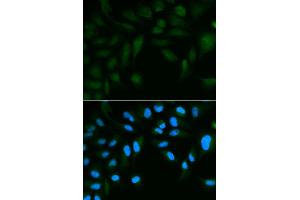 Immunofluorescence analysis of HepG2 cell using EPPIN antibody. (Eppin Antikörper)