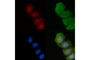 ABIN6264187 and ABIN6274036 staining Hela cells(45 min of heat-shock) by IF/ICC. (PIK3R2 Antikörper  (C-Term))
