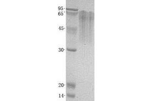 Western Blotting (WB) image for Triggering Receptor Expressed On Myeloid Cells 4 (TREM4) (Transcript Variant 4) protein (His tag) (ABIN2713627)