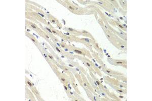 Immunohistochemistry of paraffin-embedded mouse heart using UPF1 antibody at dilution of 1:100 (x40 lens). (RENT1/UPF1 Antikörper)