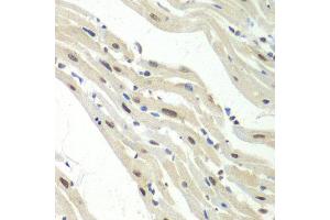 Immunohistochemistry of paraffin-embedded mouse heart using UPF1 antibody at dilution of 1:100 (x40 lens).