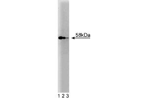 Western blot analysis of hHR23B on a A431 cell lysate (Human epithelial carcinoma, ATCC CRL-1555). (RAD23B Antikörper  (AA 73-193))