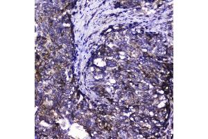 IHC analysis of Cdk6 using anti-Cdk6 antibody (ABIN5692992). (CDK6 Antikörper  (AA 1-326))