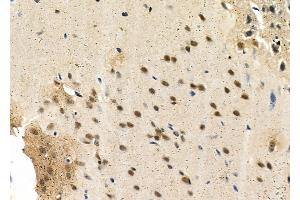 ABIN6263139 and ABIN6266820 at 1/100 staining Rat brain tissue by IHC-P. (MAST3 Antikörper  (Internal Region))