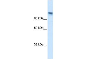 WB Suggested Anti-TIP120A Antibody Titration:  1. (CAND1 Antikörper  (N-Term))