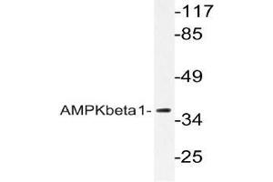 Western blot (WB) analyzes of AMPKbeta1 antibody in extracts from Jurkat cells. (PRKAB1 Antikörper)