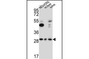 TAF1D Antibody (N-term) (ABIN651786 and ABIN2840399) western blot analysis in NCI-,Jurkat cell line and mouse liver lysates (15 μg/lane). (TAF1D Antikörper  (N-Term))
