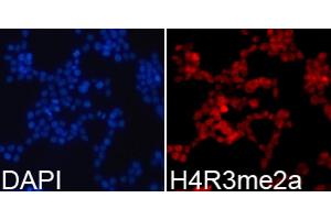 Immunofluorescence analysis of 293T cells using Asymmetric DiMethyl-Histone H4-R3 antibody (ABIN3016059, ABIN3016060, ABIN3016061, ABIN1680261 and ABIN6219537). (Histone H4 Antikörper  (2meArg3))