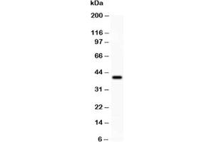 Western blot testing of PD1 antibody and recombinant human PD1 protein 0.