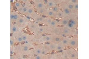 DAB staining on fromalin fixed paraffin- embedded Kidney tissue) (Albumin Antikörper  (AA 25-609))