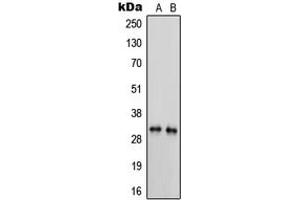Western blot analysis of Trypsin 3 expression in MDAMB231 (A), HL60 (B) whole cell lysates.
