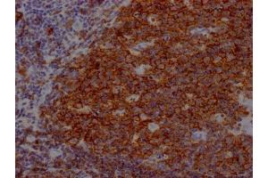 IHC image of ABIN7127396 diluted at 1:100 and staining in paraffin-embedded human tonsil tissue performed on a Leica BondTM system. (Rekombinanter CD19 Antikörper)