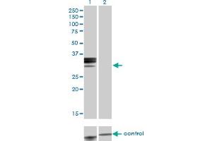 Western blot analysis of HPX over-expressed 293 cell line, cotransfected with HPX Validated Chimera RNAi (Lane 2) or non-transfected control (Lane 1). (Hemopexin Antikörper  (AA 1-254))