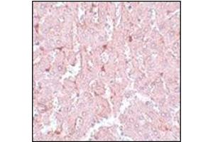 Immunohistochemistry of LXR-A in rat liver tissue with this product at 5 μg/ml. (NR1H3 Antikörper  (N-Term))