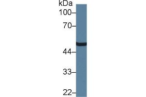 Detection of CPN1 in Human Raji cell lysate using Polyclonal Antibody to Carboxypeptidase N1 (CPN1) (CPN1 Antikörper  (AA 159-325))