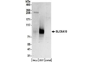 Western Blotting (WB) image for anti-Solute Carrier Family 6 (Neutral Amino Acid Transporter), Member 15 (SLC6A15) (AA 653-703) antibody (ABIN7449823)