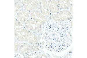 Immunohistochemistry of paraffin-embedded Human kidney (negative control sample) using CD79a antibody (ABIN7265805) at dilution of 1:100 (40x lens). (CD79a Antikörper)