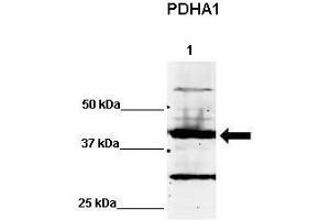 WB Suggested Anti-PDHA1 Antibody    Positive Control:  Lane 1: 60ug human NT2 cell line   Primary Antibody Dilution :   1:500  Secondary Antibody :  IRDye 800 CW goat anti-rabbit from Li-COR Bioscience  Secondry Antibody Dilution :   1:20,000  Submitted by:  Dr. (PDHA1 Antikörper  (C-Term))