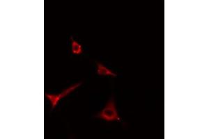 ABIN6269299 staining Hela cells by IF/ICC. (ADAM17 Antikörper  (C-Term))