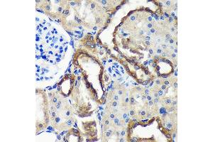 Immunohistochemistry of paraffin-embedded Rat kidney using C18orf8 Rabbit pAb (ABIN7266379) at dilution of 1:100 (40x lens). (C18orf8 Antikörper  (AA 1-300))