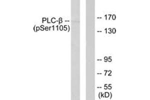Western blot analysis of extracts from A431 cells, using PLCB3 (Phospho-Ser1105) Antibody. (PLCB3 Antikörper  (pSer1105))