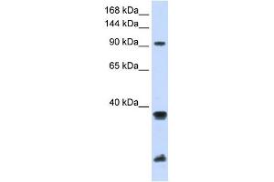 RNF20 antibody used at 1 ug/ml to detect target protein.