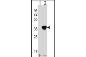 Western Blotting (WB) image for anti-Aldo-Keto Reductase Family 1, Member A1 (Aldehyde Reductase) (AKR1A1) (AA 293-325), (C-Term) antibody (ABIN389204)
