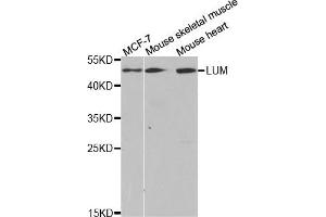 Western Blotting (WB) image for anti-Lumican (LUM) antibody (ABIN1876540) (LUM Antikörper)