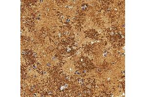 IHC analysis of Aquaporin 4/AQP4 using anti-Aquaporin 4/AQP4 antibody (ABIN7600876).