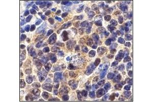 Immunohistochemistry (Paraffin-embedded Sections) (IHC (p)) image for anti-Baculoviral IAP Repeat-Containing 5 (BIRC5) (C-Term) antibody (ABIN500292)