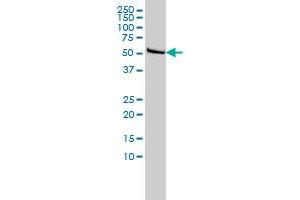 DLD monoclonal antibody (M02), clone 3C1 Western Blot analysis of DLD expression in Hela . (DLD Antikörper  (AA 1-509))