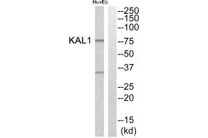 Western Blotting (WB) image for anti-Kallmann Syndrome 1 Sequence (KAL1) (Internal Region) antibody (ABIN1850776) (KAL1 Antikörper  (Internal Region))