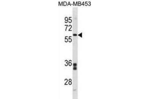 Western Blotting (WB) image for anti-Flavin Containing Monooxygenase 5 (FMO5) antibody (ABIN3001414) (FMO5 Antikörper)