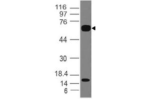 Image no. 1 for anti-Interleukin 1 Receptor-Like 2 (IL1RL2) (AA 1-203) antibody (ABIN5027302) (IL1RL2 Antikörper  (AA 1-203))