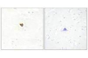 Immunohistochemistry analysis of paraffin-embedded human brain tissue using JKIP2 antibody. (JAKMIP2 Antikörper  (C-Term))