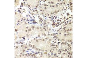 Immunohistochemistry (Paraffin-embedded Sections) (IHC (p)) image for anti-PRP3 Pre-mRNA Processing Factor 3 Homolog (PRPF3) (AA 1-280) antibody (ABIN6146260)