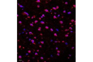 Immunohistochemistry (Paraffin-embedded Sections) (IHC (p)) image for anti-Cadherin 19 (CDH19) antibody (ABIN7073258)