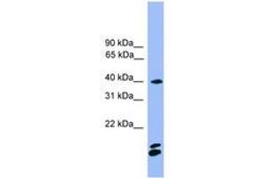 Image no. 1 for anti-Nuclear Factor of Activated T-Cells, Cytoplasmic, Calcineurin-Dependent 1 (NFATC1) (AA 201-250) antibody (ABIN6745329) (NFATC1 Antikörper  (AA 201-250))