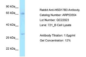 Western Blotting (WB) image for anti-Hydroxysteroid (17-Beta) Dehydrogenase 3 (HSD17B3) (N-Term) antibody (ABIN2785439)