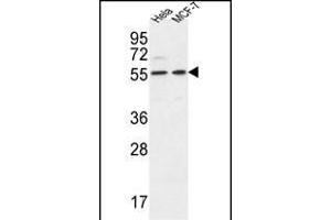 DDX6 Antibody (Center) (ABIN653855 and ABIN2843115) western blot analysis in Hela,MCF-7 cell line lysates (35 μg/lane). (DDX6 Antikörper  (AA 348-375))