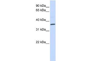 WB Suggested Anti-CCR5 Antibody Titration: 0.
