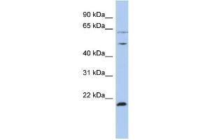 WB Suggested Anti-PSMC2 Antibody Titration:  0.