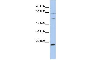 WB Suggested Anti-PSMC2 Antibody Titration:  0. (PSMC2 Antikörper  (N-Term))